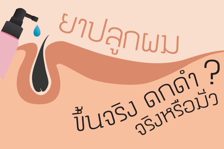 ยาปลูกผม ขึ้นจริง ดกดำ จริงหรือมั่ว?