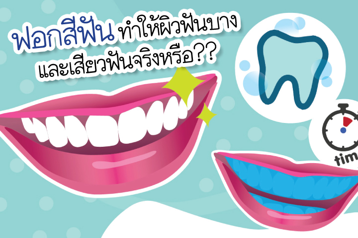 ฟอกสีฟัน ทำให้ผิวฟันบาง และเสียวฟันจริงหรือ?