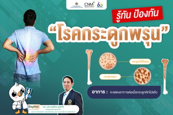 รู้ทัน ป้องกัน โรคกระดูกพรุน