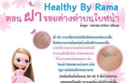 Healthy By Rama ตอน ฝ้า... รอยด่างดำบนใบหน้า