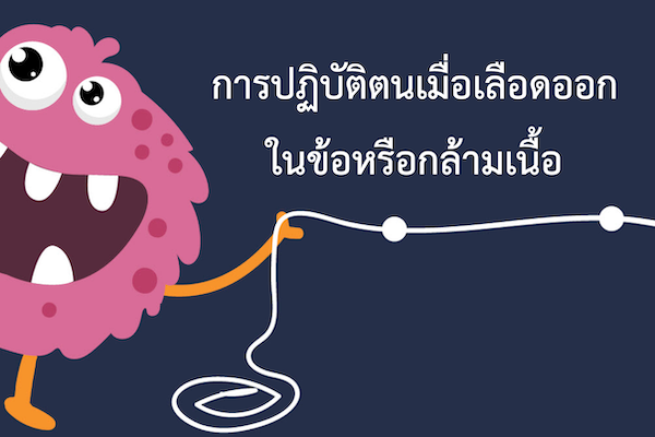 การปฏิบัติตนเมื่อเลือดออกในข้อหรือกล้ามเนื้อ