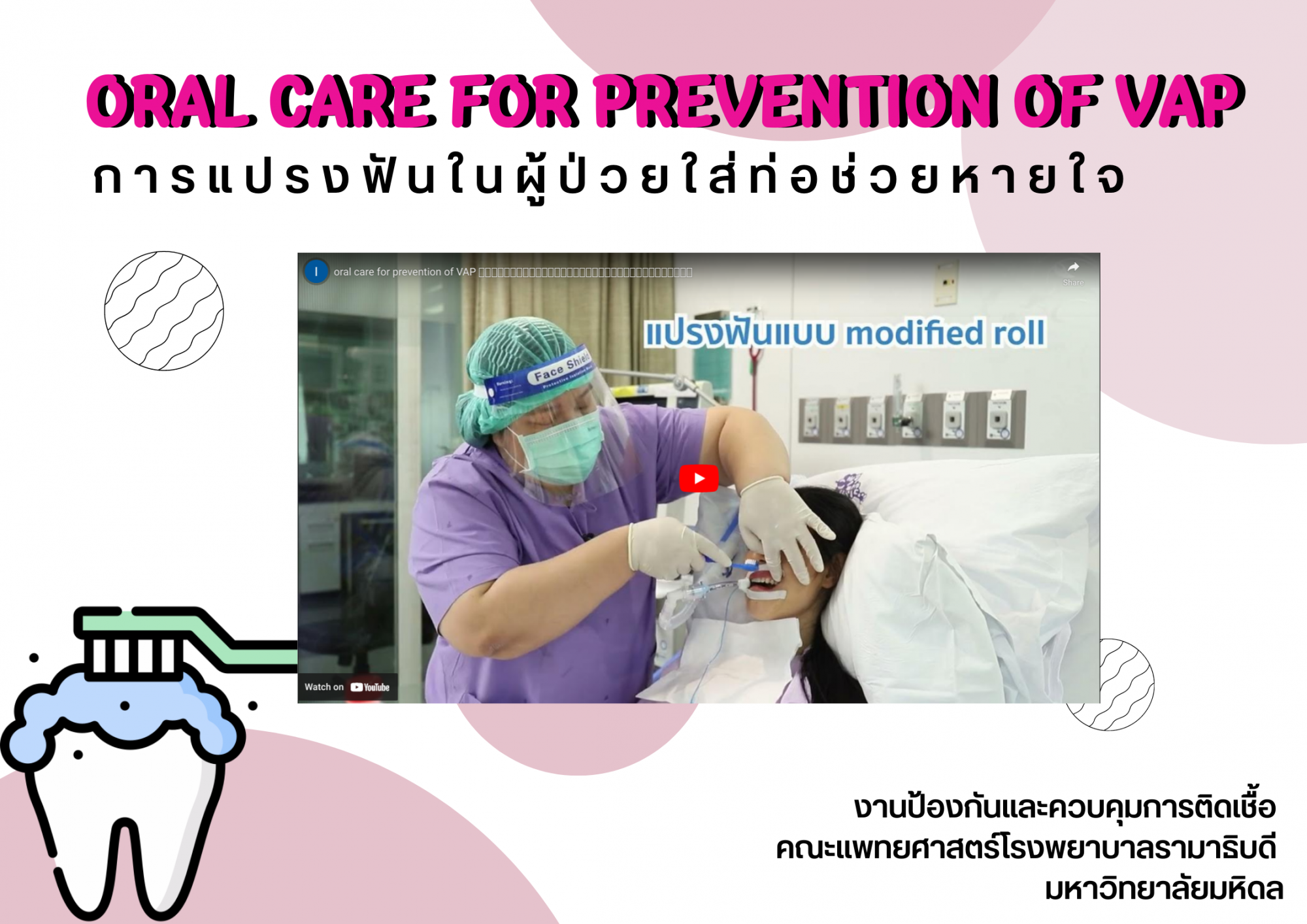 การทำความสะอาดช่องปากในผู้ป่วยใส่ท่อช่วยหายใจ