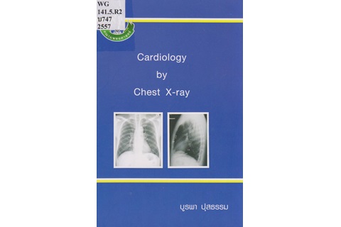 Cardiology by chest X-ray