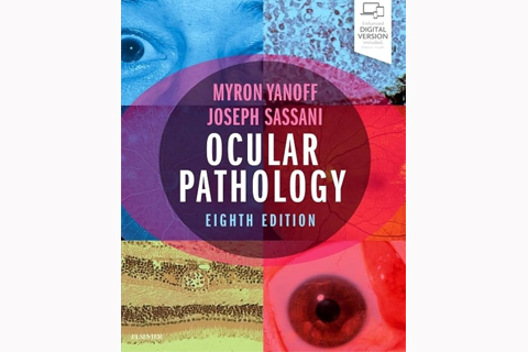 Ocular Pathology, Eighth Edition