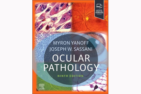 Ocular Pathology, Ninth Edition