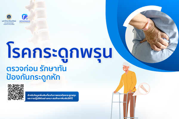 โรคกระดูกพรุน ตรวจก่อน รักษาทัน ป้องกันกระดูกหัก