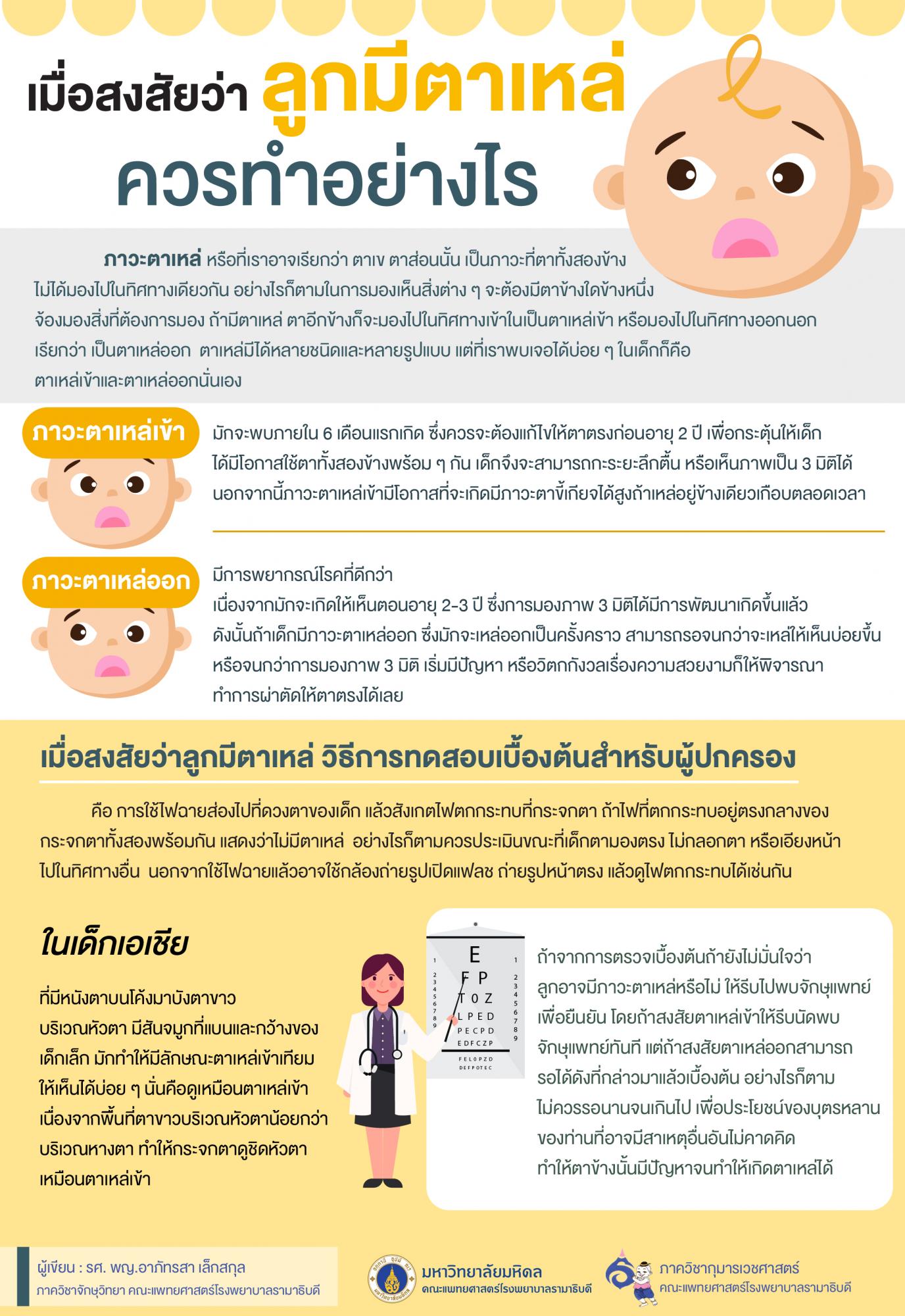 เมื่อสงสัยว่าลูกตาเหล่ ควรทำอย่างไร