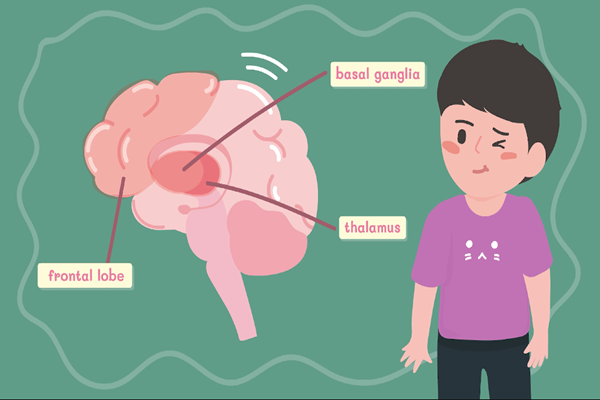 ความรู้ทั่วไปเกี่ยวกับโรคติกส์ 