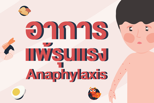 อาการแพ้รุนแรง (Anaphylaxis)