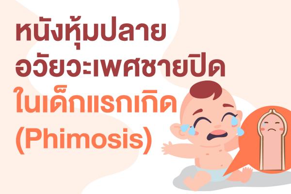 หนังหุ้มปลายอวัยวะเพศชายปิดในเด็กแรกเกิด