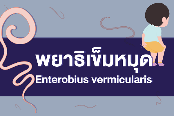 พยาธิเข็มมุด Enterobius Vermicularis