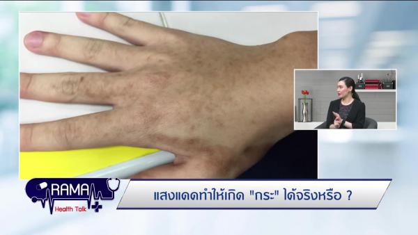แสงแดดทำให้เกิด "กระ" ได้จริงหรือ ?