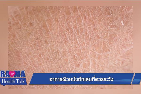 อาการผิวหนังอักเสบที่ควรระวัง