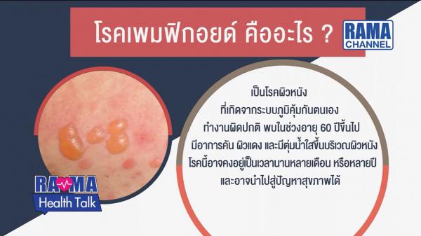 “โรคเพมฟิกอยด์” หรือ “โรคตุ่มน้ำพองใส” ไม่ใช่โรคติดต่อ