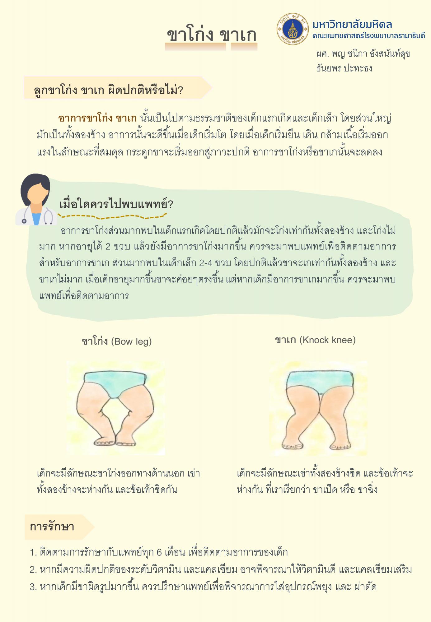 ขาโก่ง ขาเก