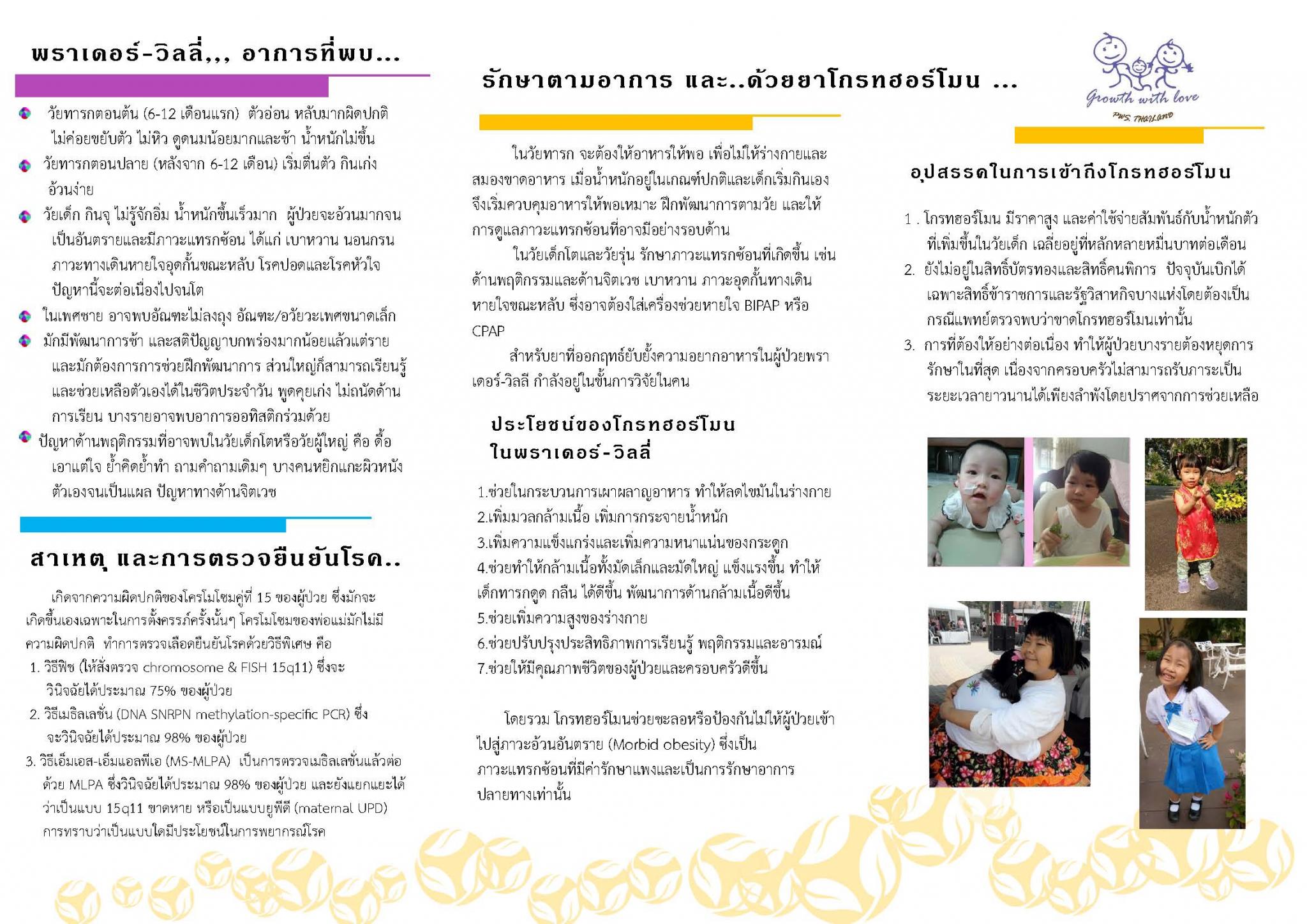 กลุ่มอาการพราเดอร์_วิลลี