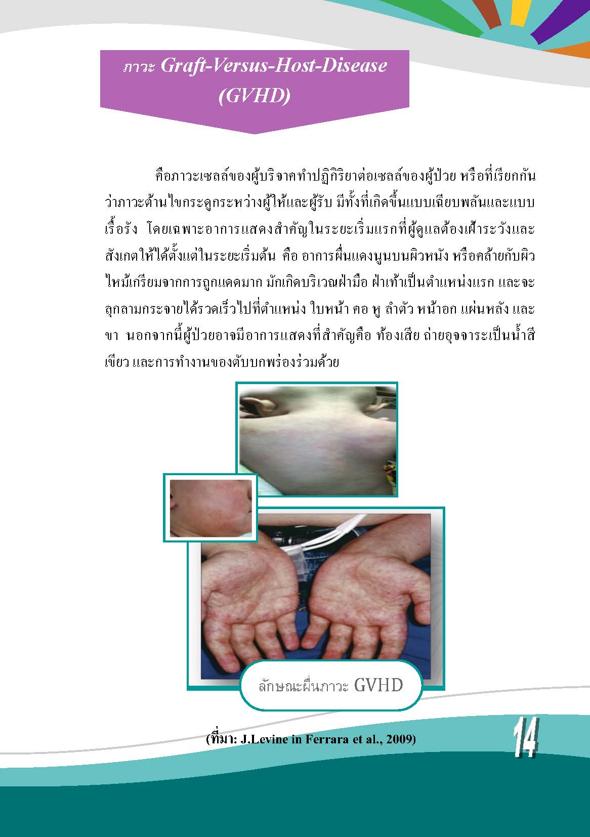 การดูแลผู้ป่วยเด็กหลังได้รับการปลูกถ่ายเซลล์ต้นกำเนิดเม็ดโลหิต