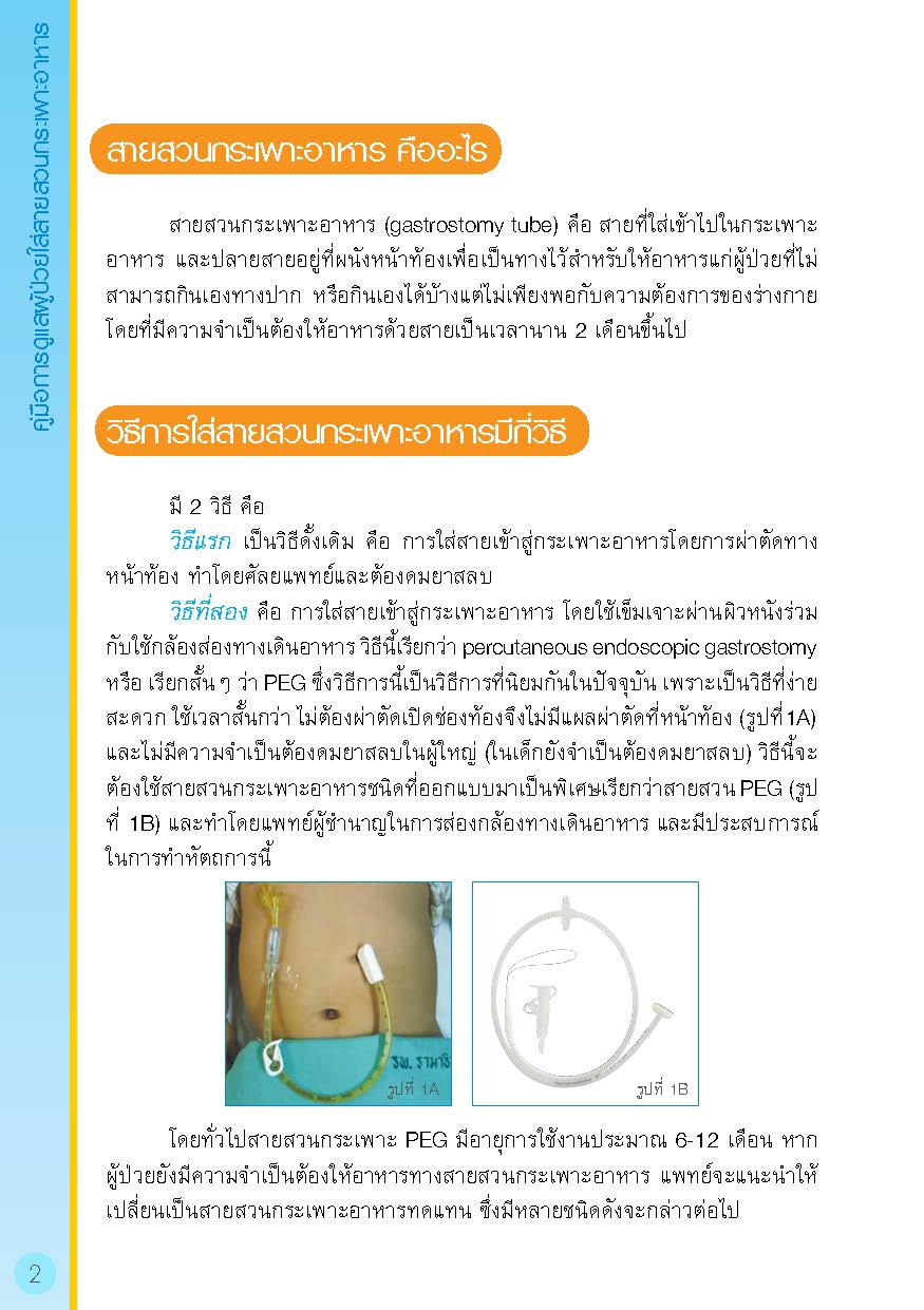 การดูแลผู้ป่วยใส่สายสวนกระเพาะอาหาร