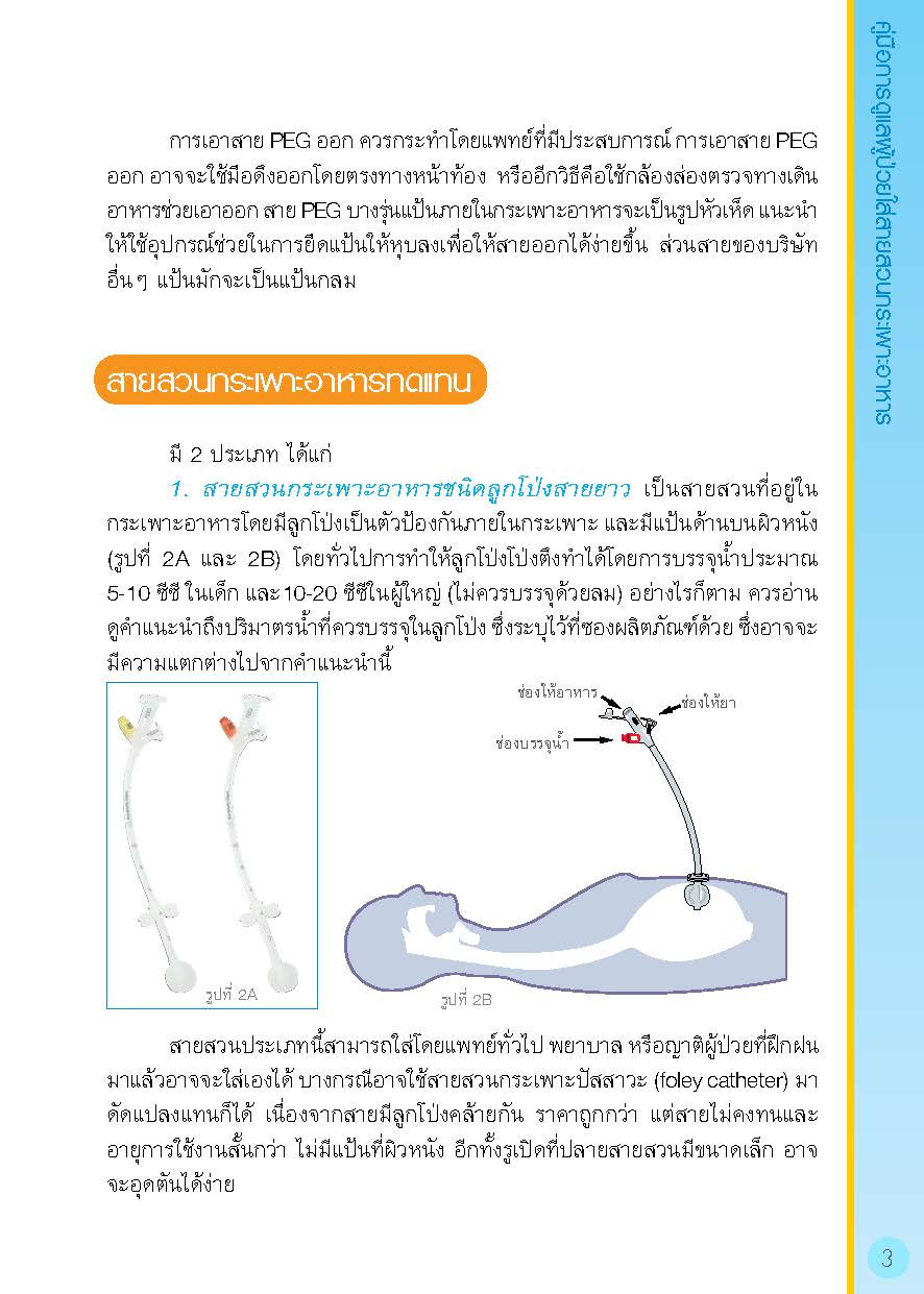 การดูแลผู้ป่วยใส่สายสวนกระเพาะอาหาร