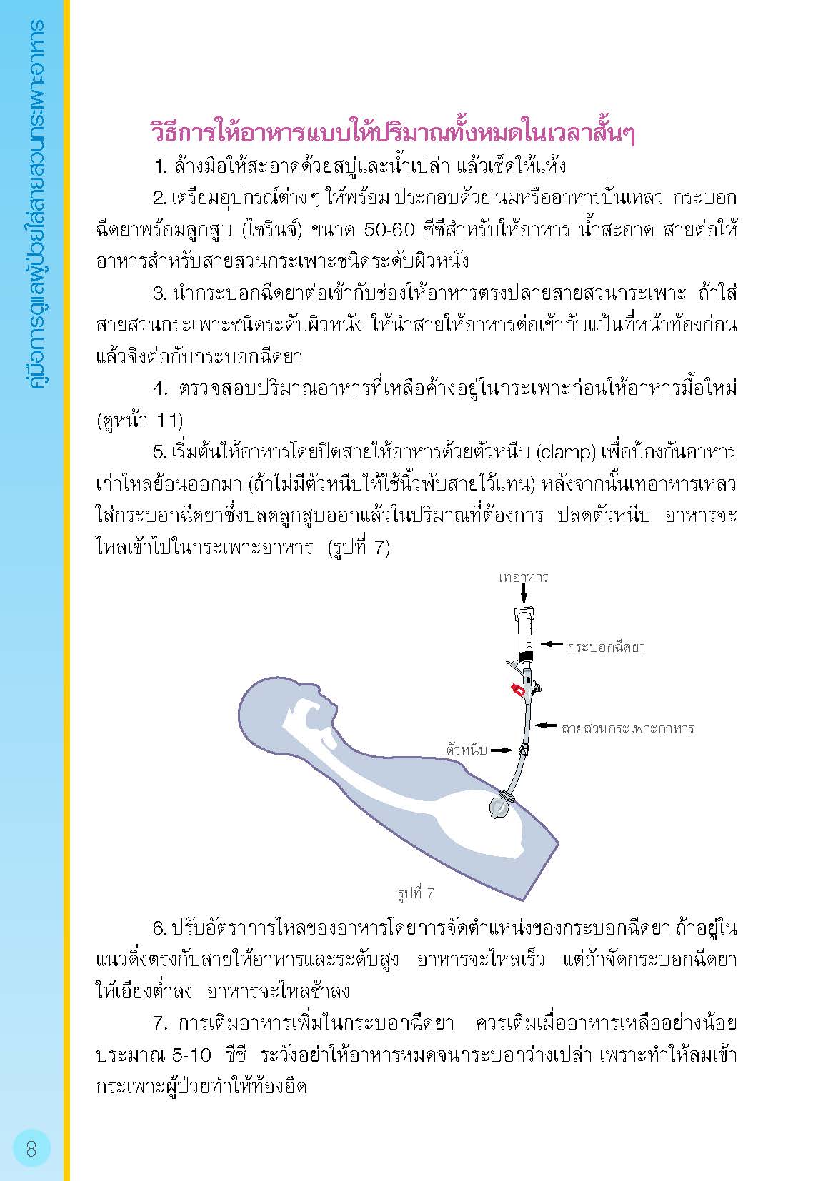 การดูแลผู้ป่วยใส่สายสวนกระเพาะอาหาร