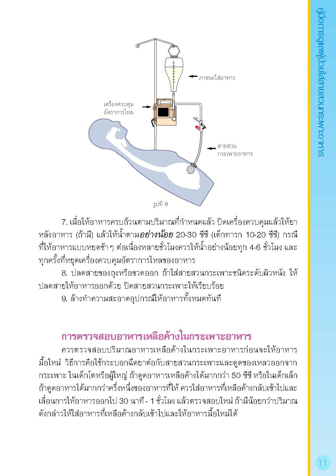 การดูแลผู้ป่วยใส่สายสวนกระเพาะอาหาร