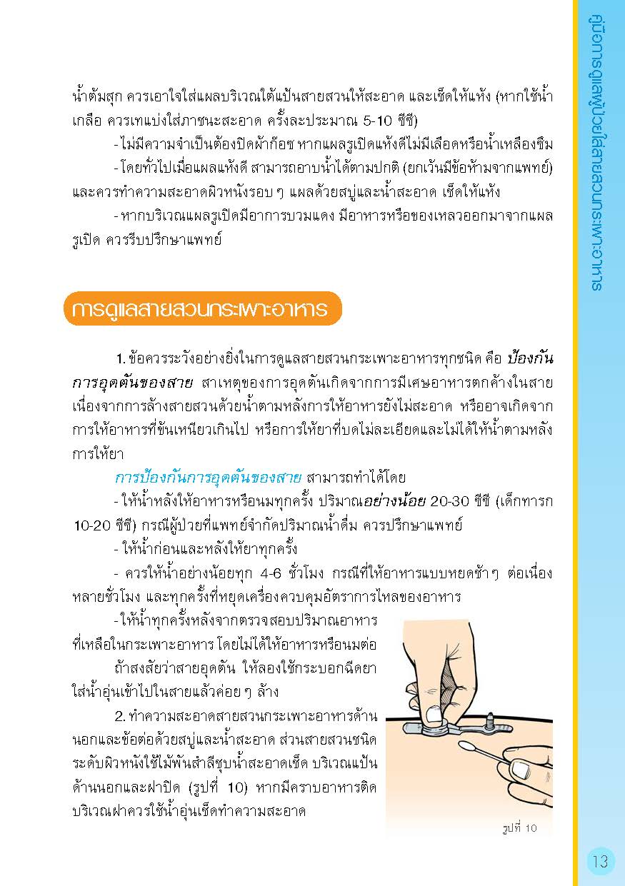 การดูแลผู้ป่วยใส่สายสวนกระเพาะอาหาร