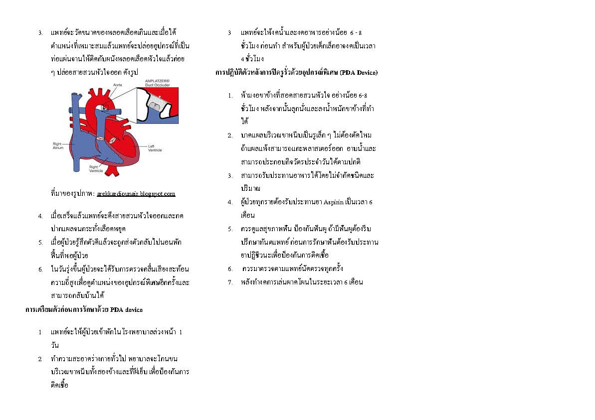 การปิดรูหลอดเลือดเกินด้วยอุปกรณ์พิเศษ