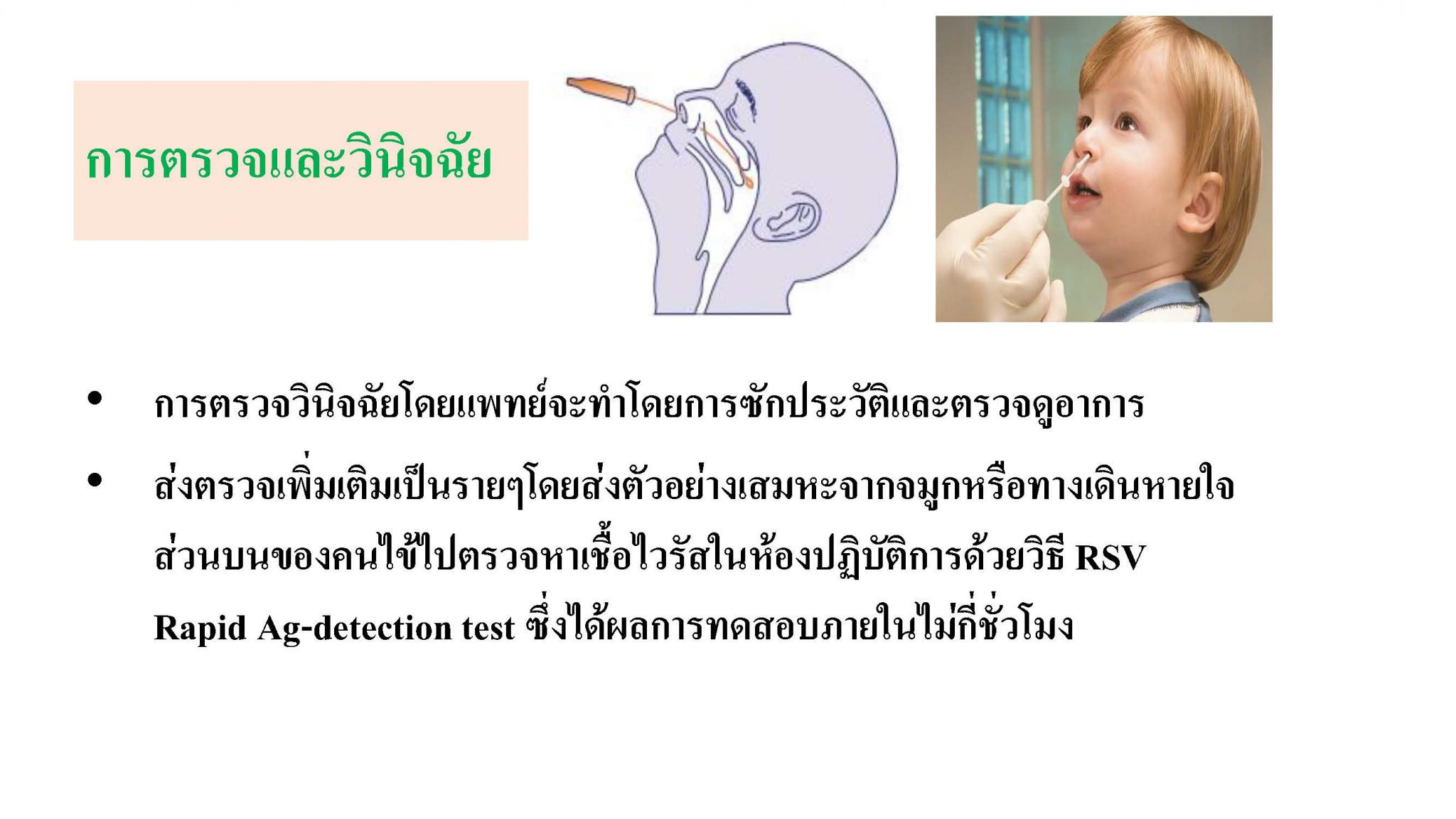 ปกป้องลูกน้อยจากไวรัส RSV