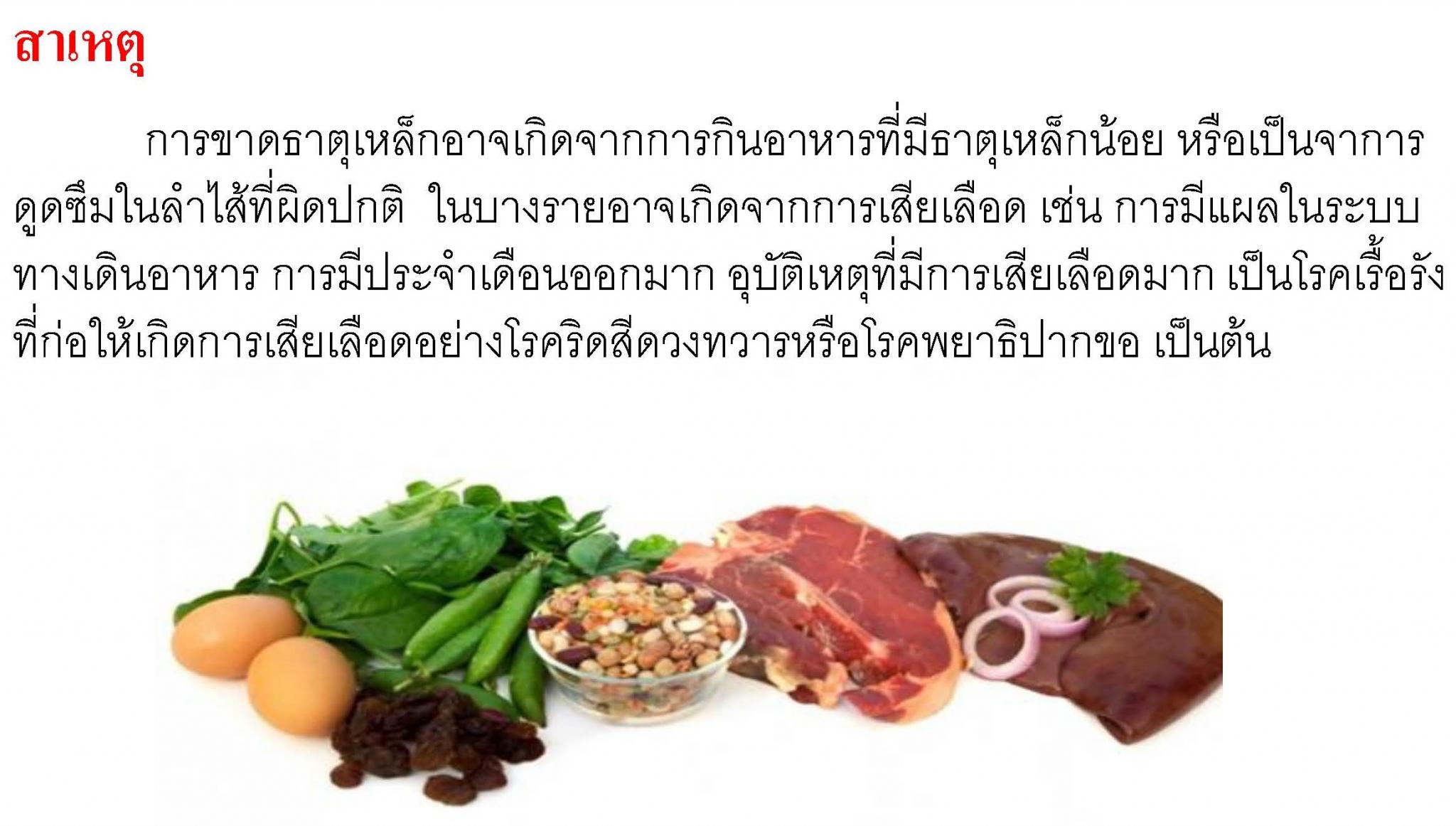ภาวะเลือดจางจากการขาดธาตุเหล็ก