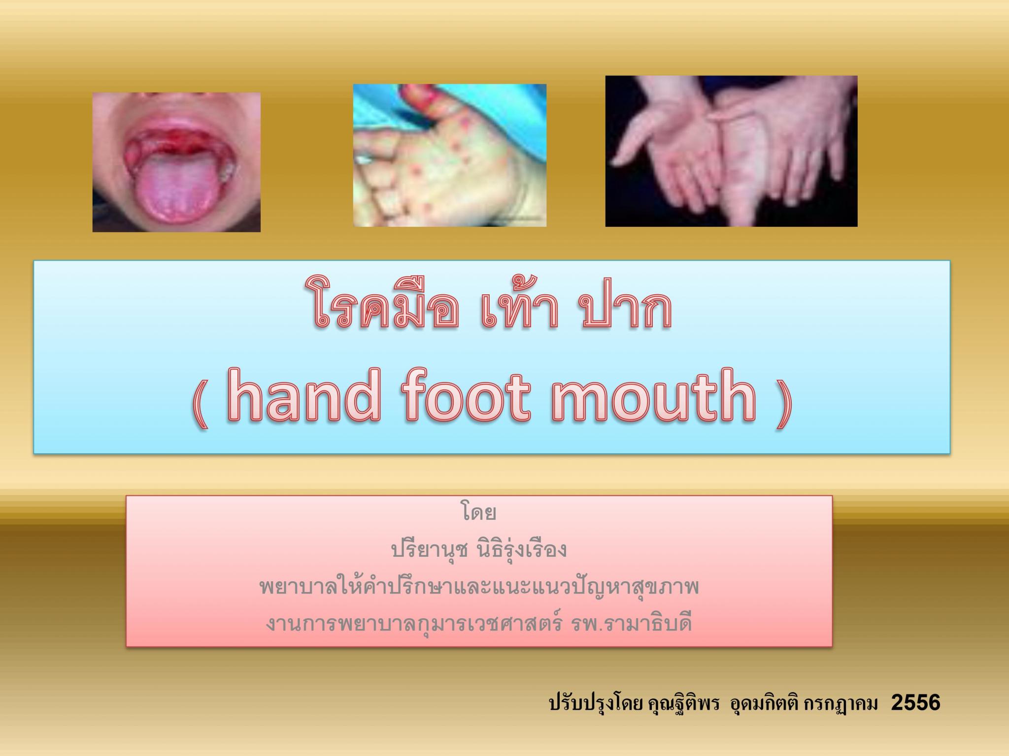 โรคมือ-เท้า-ปาก