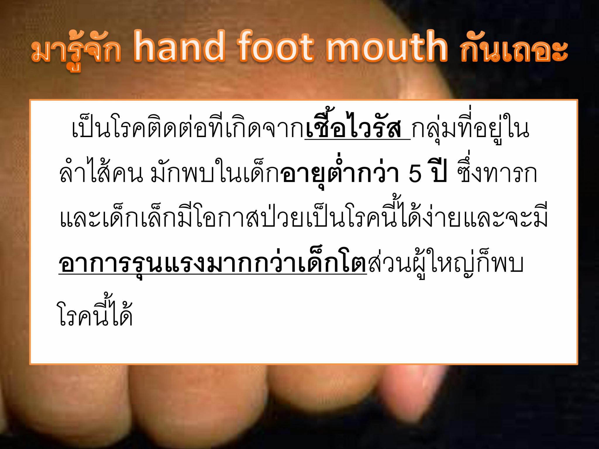 โรคมือ-เท้า-ปาก
