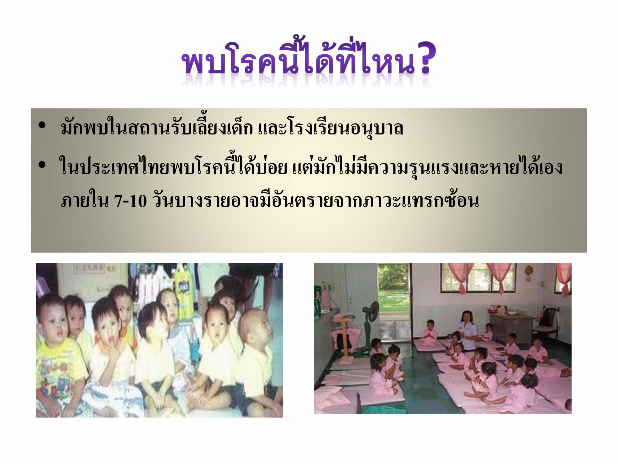 โรคมือ-เท้า-ปาก