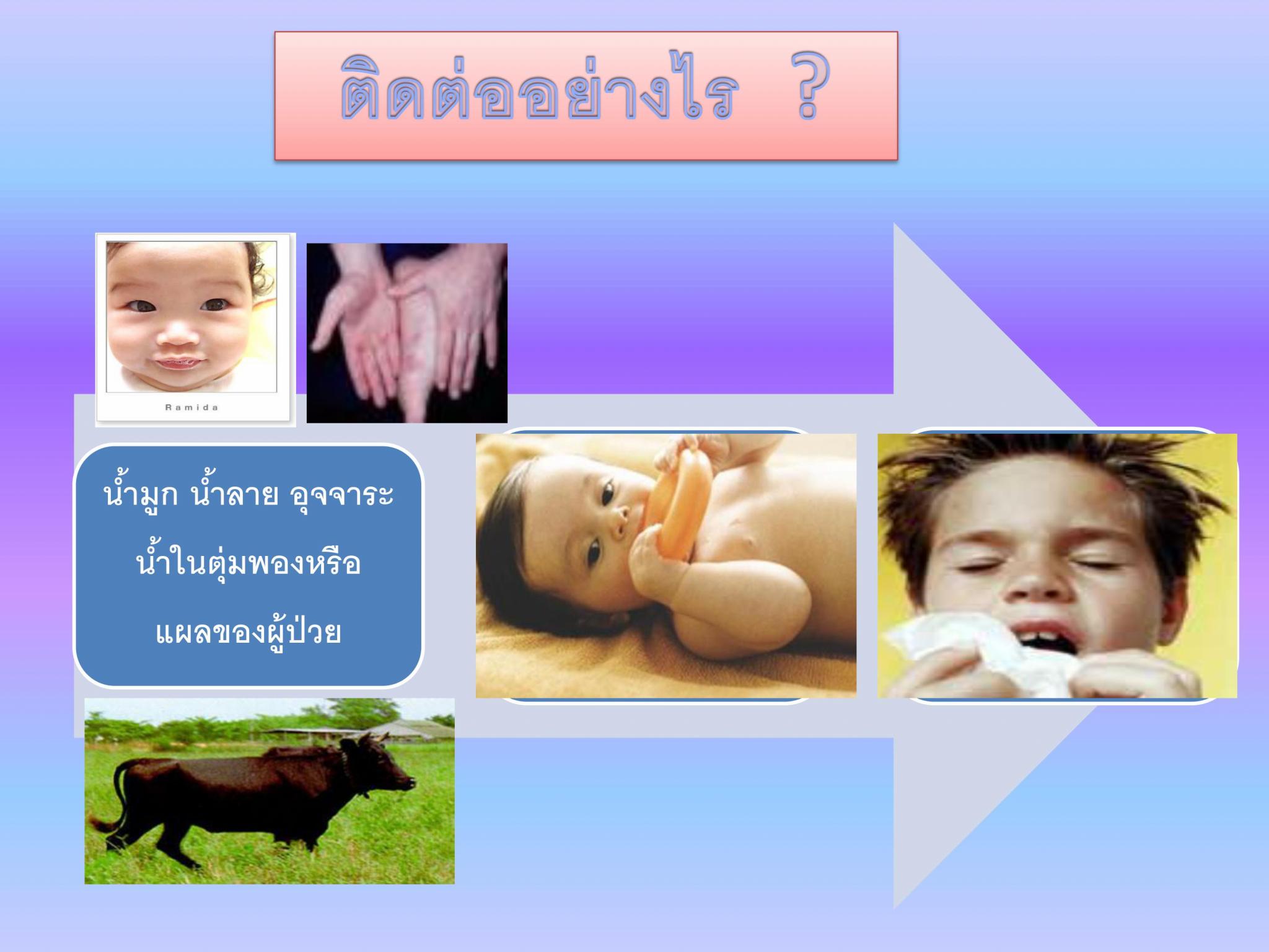 โรคมือ-เท้า-ปาก