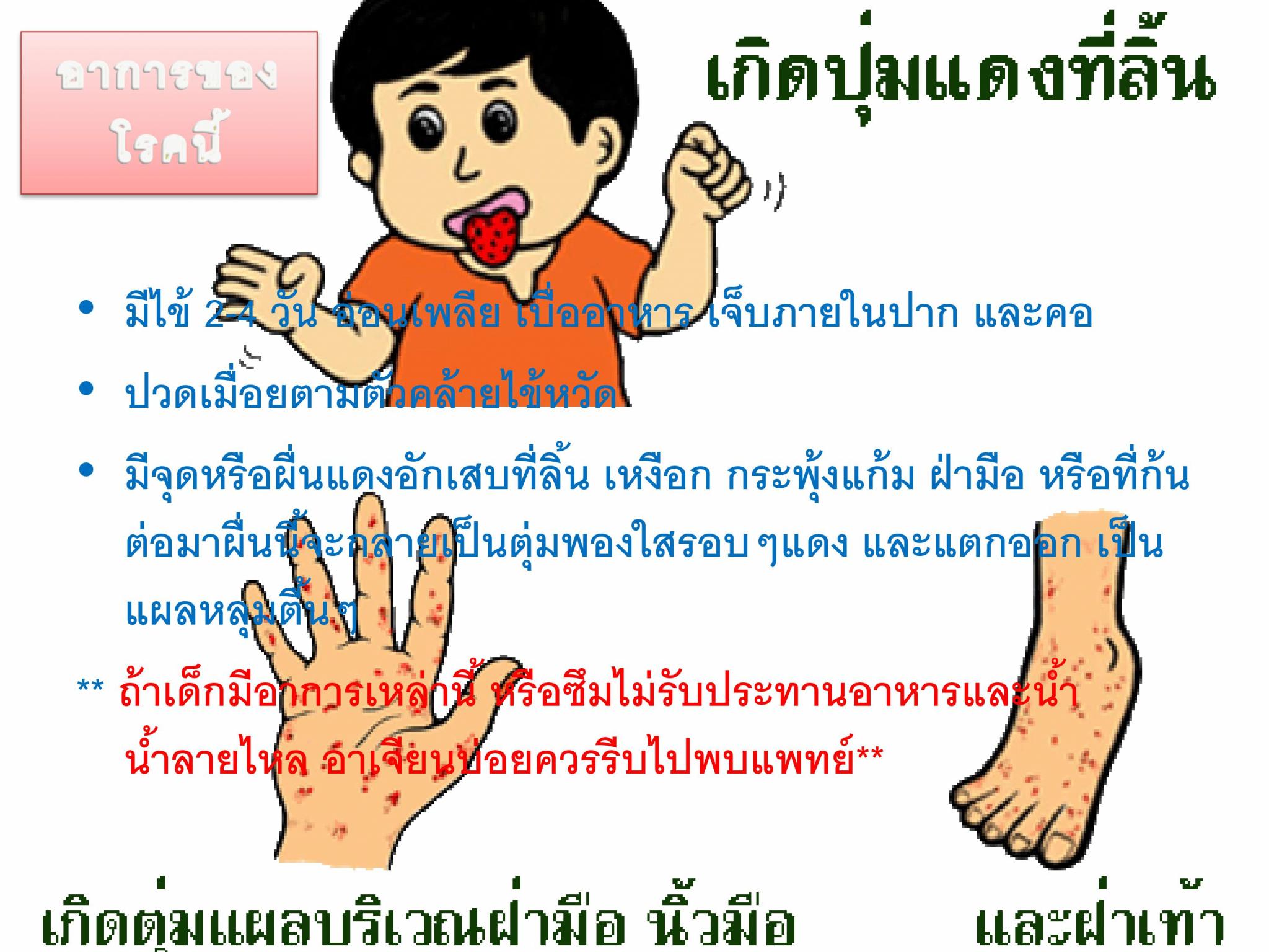 โรคมือ-เท้า-ปาก