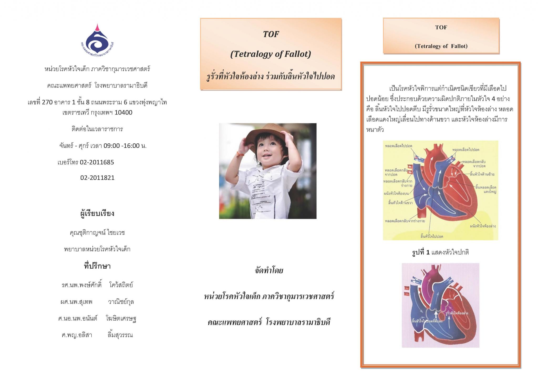 รูรั่วที่หัวใจห้องล่างร่วมกับลิ้นหัวใจไปปอดตีบ