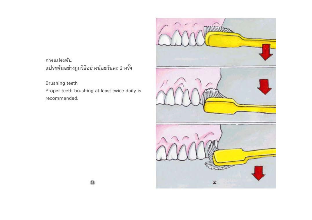 อยู่อย่างมีความสุขกับโรคเลือดออกง่ายฮีโมฟีเลีย