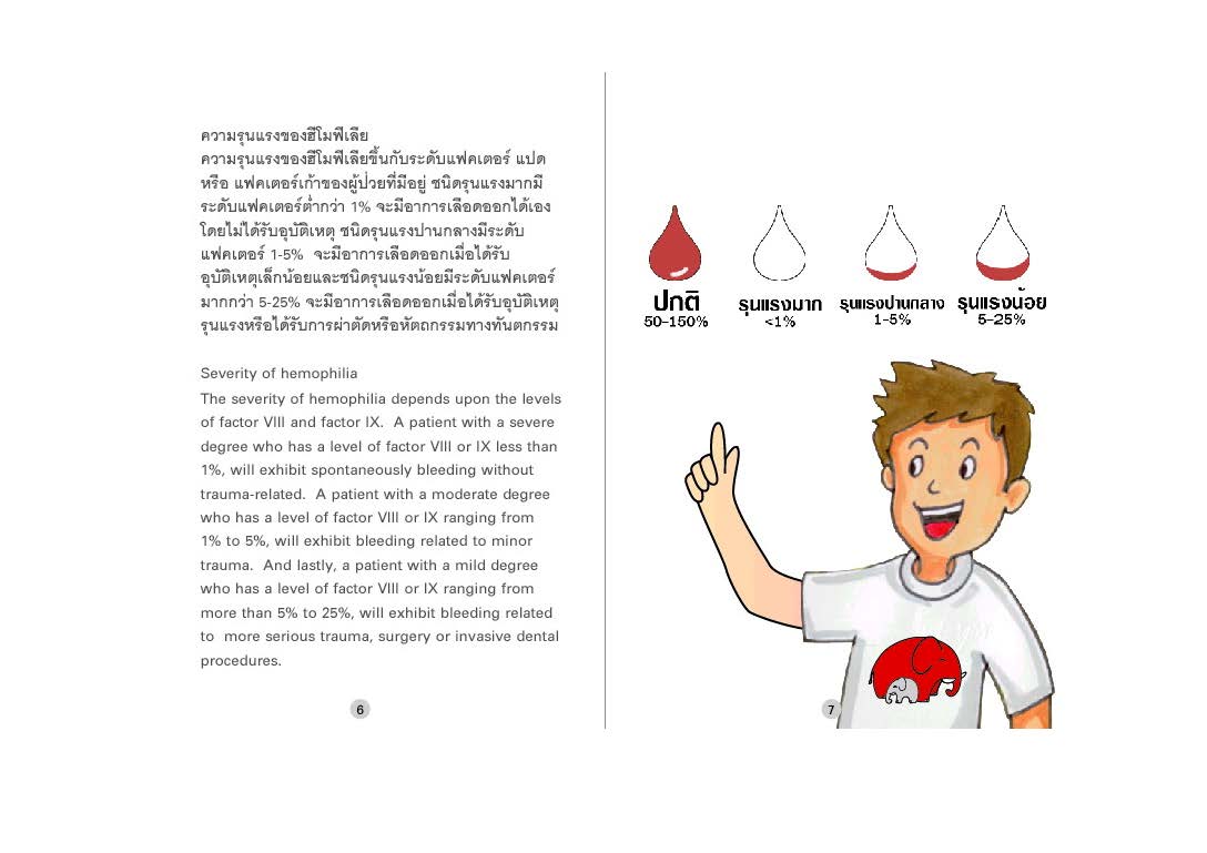 อยู่อย่างมีความสุขกับโรคเลือดออกง่ายฮีโมฟีเลีย