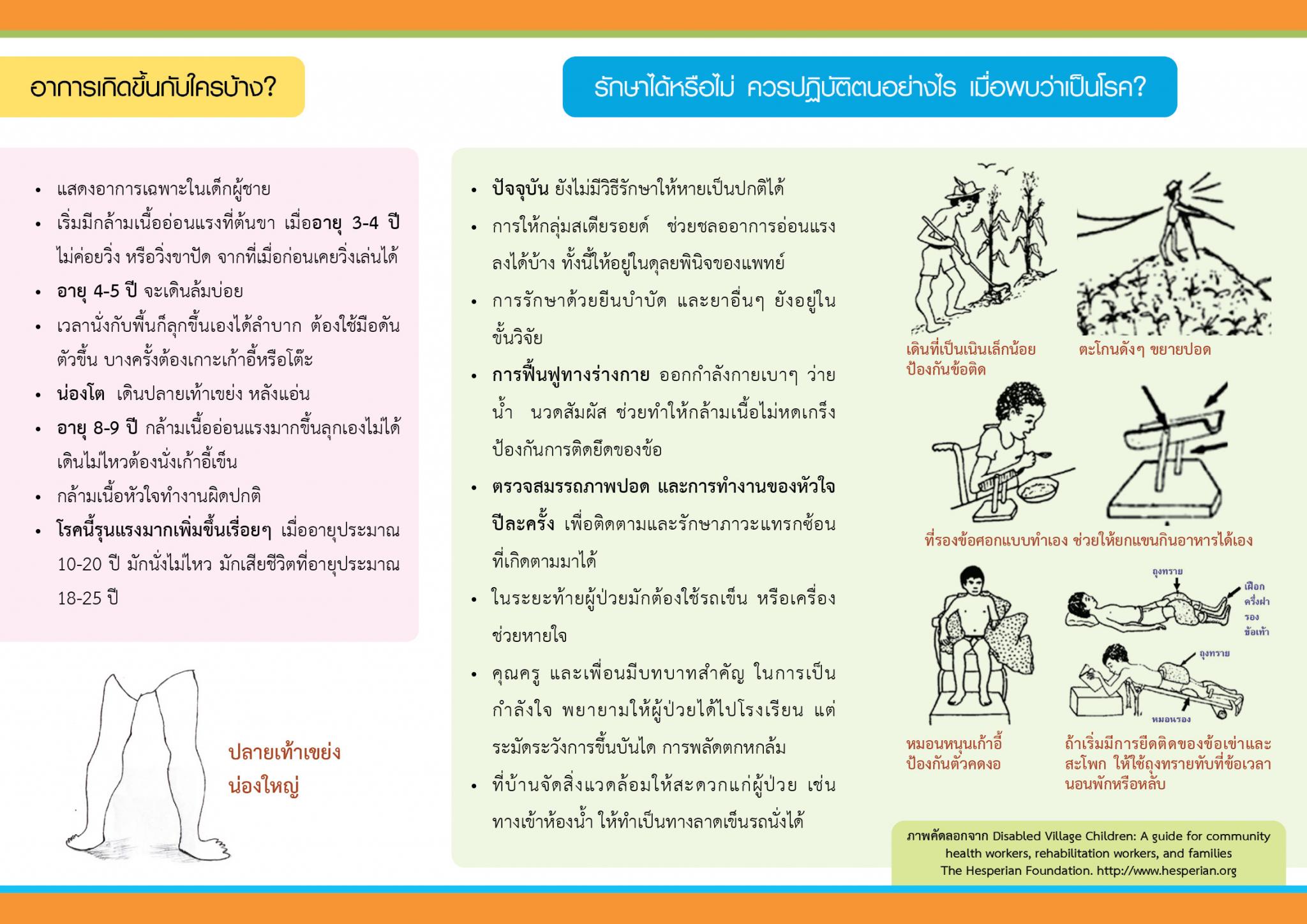 โรคกล้ามเนื้อเสื่อมพันธุกรรมในเด็ก