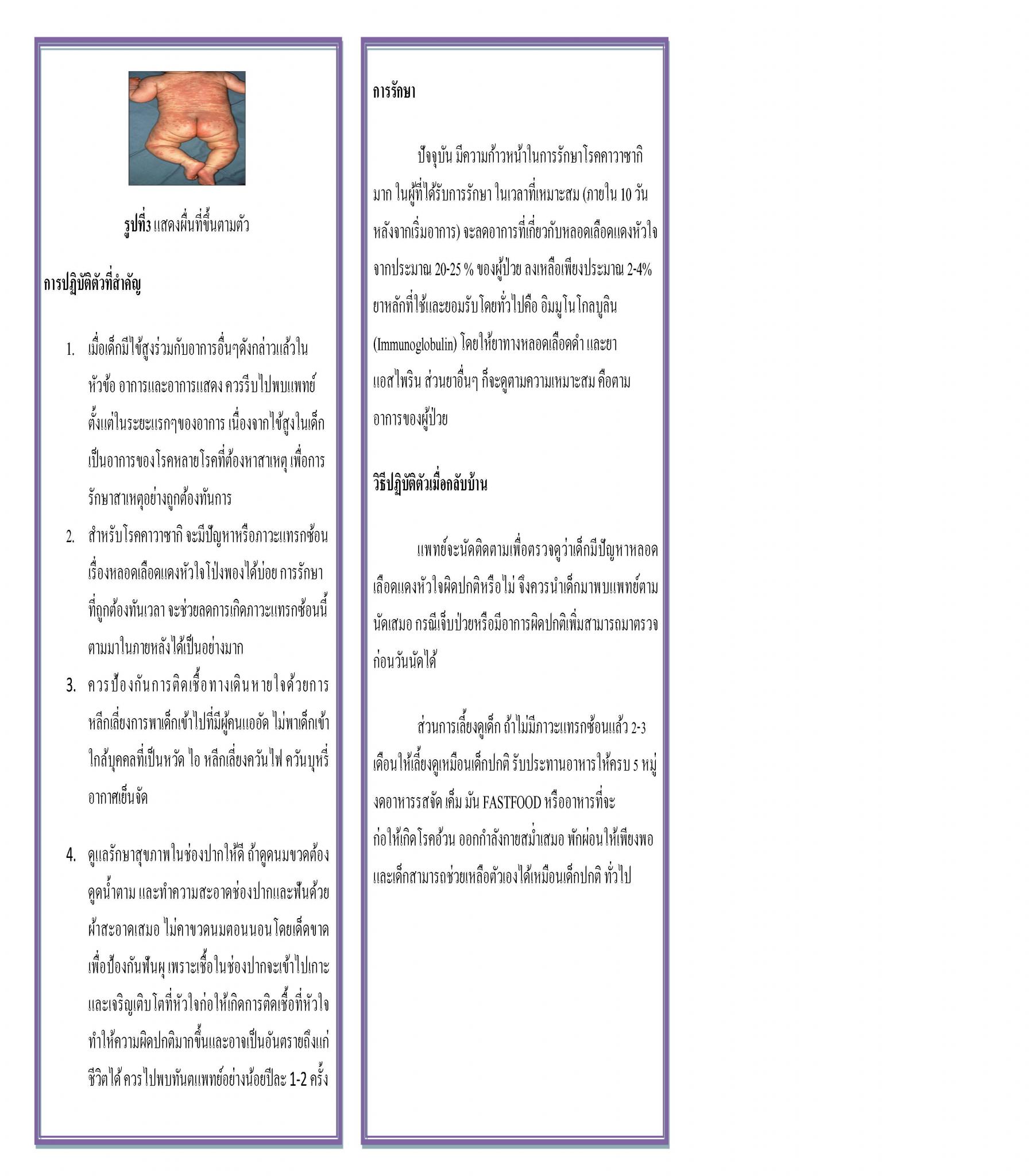 โรคคาวาซากิ