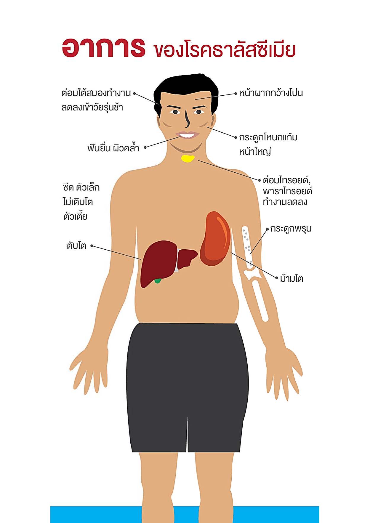 โรคธาลัสซีเมียคืออะไร