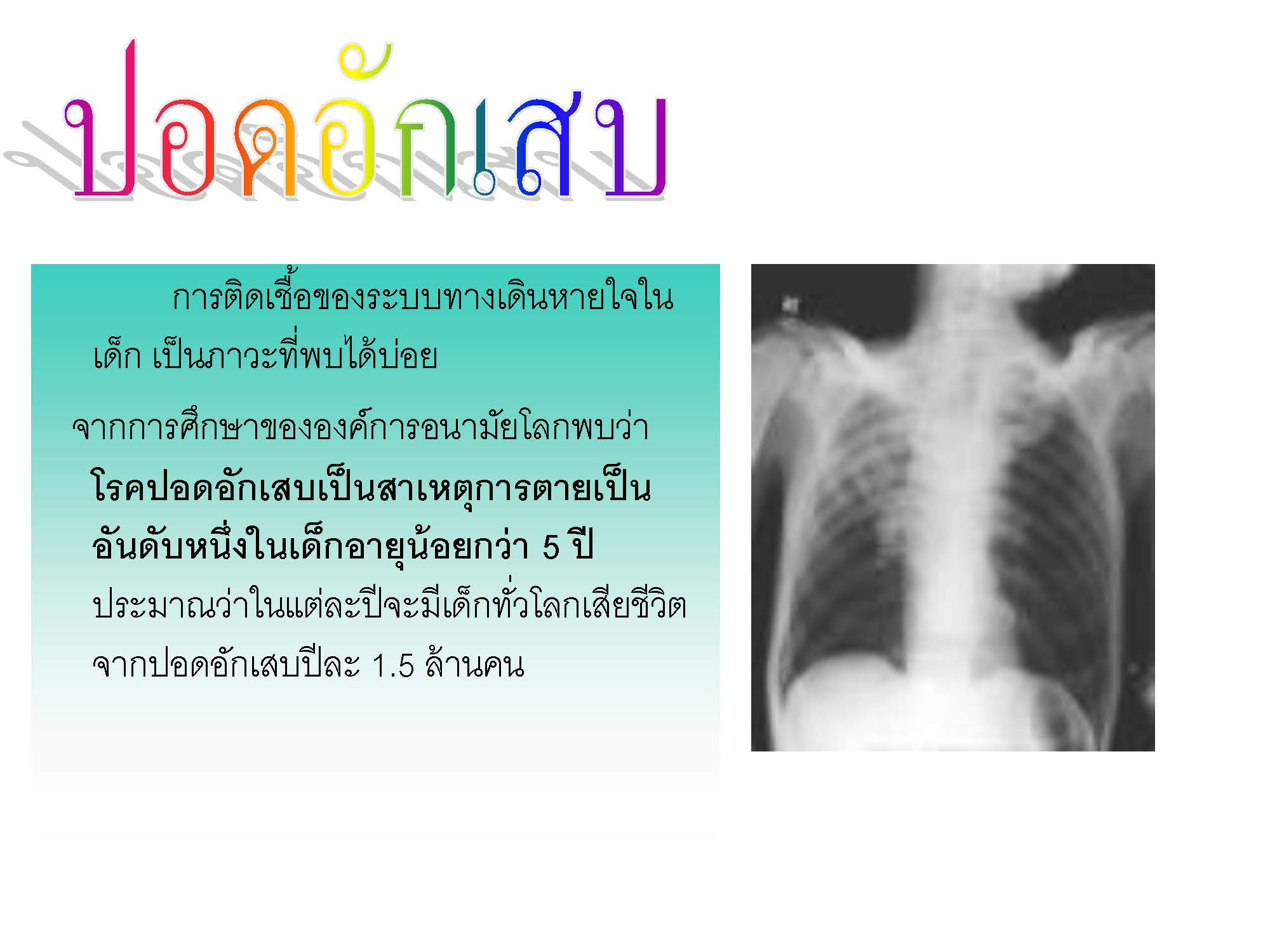 โรคปอดอักเสบ