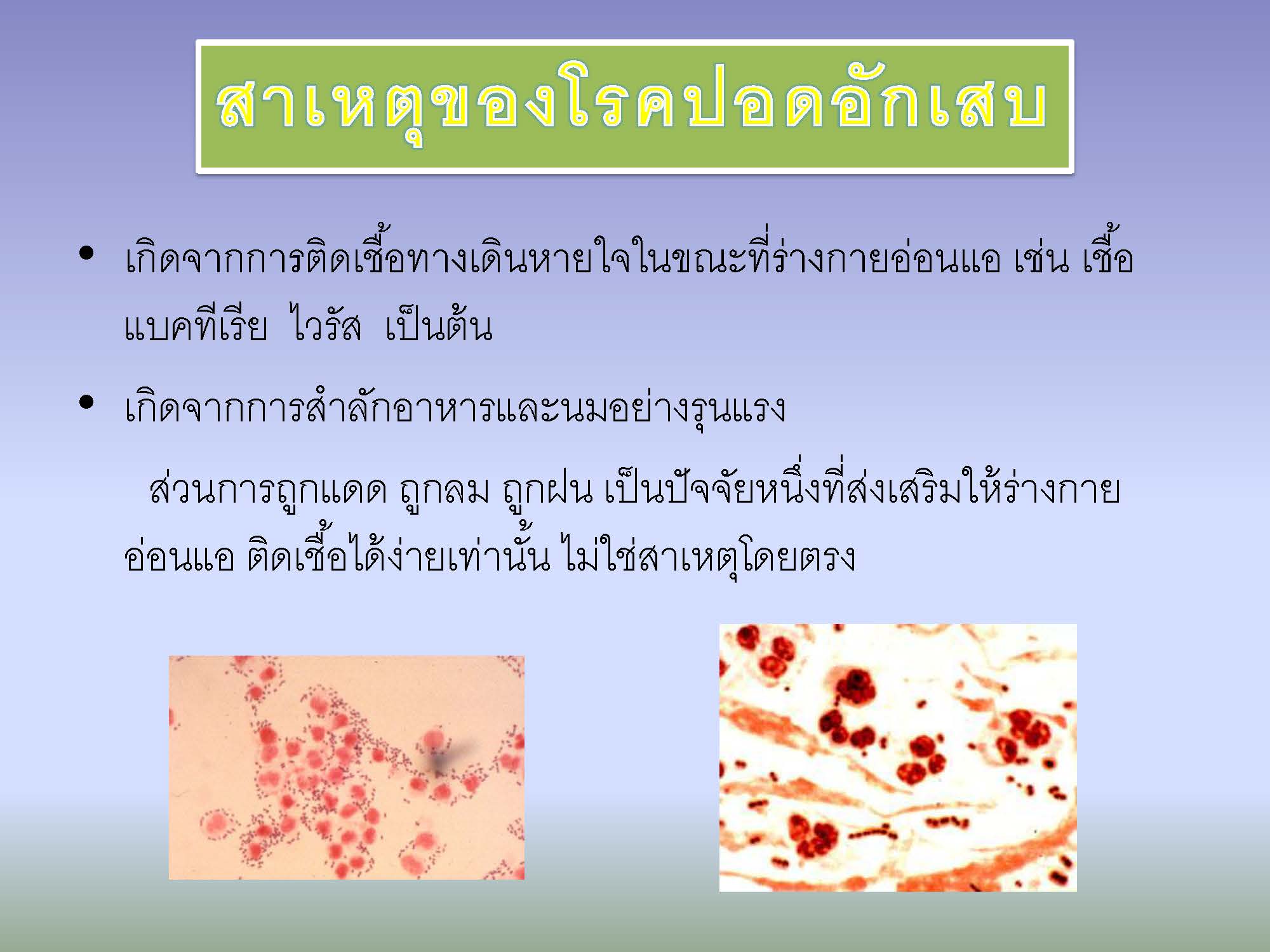 โรคปอดอักเสบ