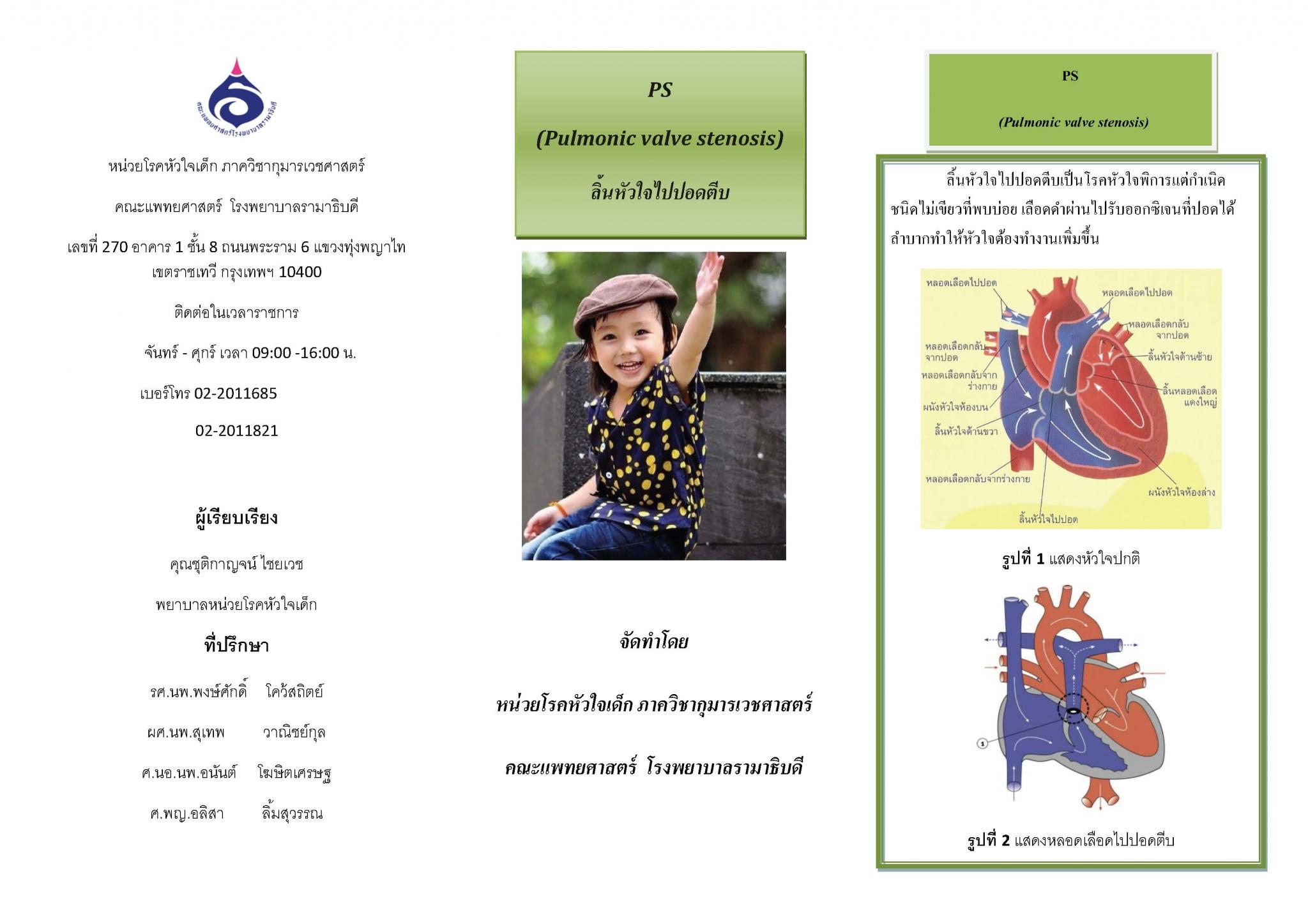 โรคลิ้นหัวใจไปปอดตีบ
