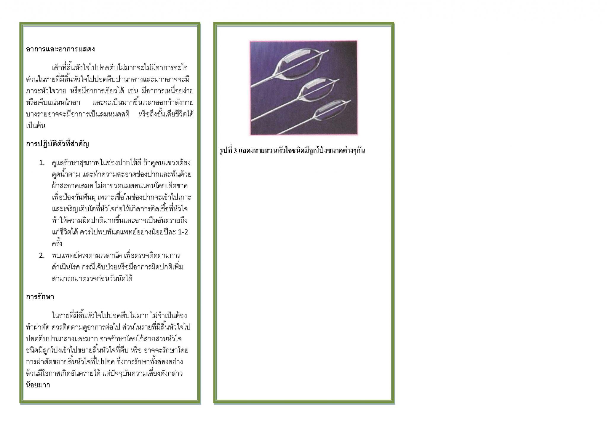 โรคลิ้นหัวใจไปปอดตีบ