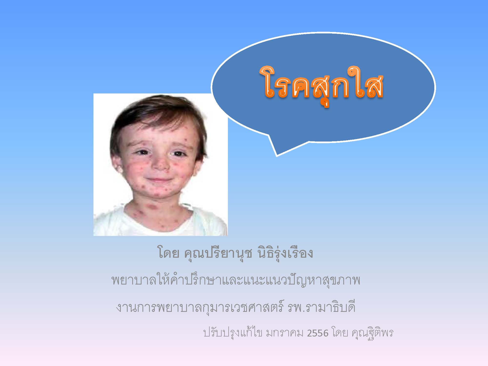 โรคสุกใส