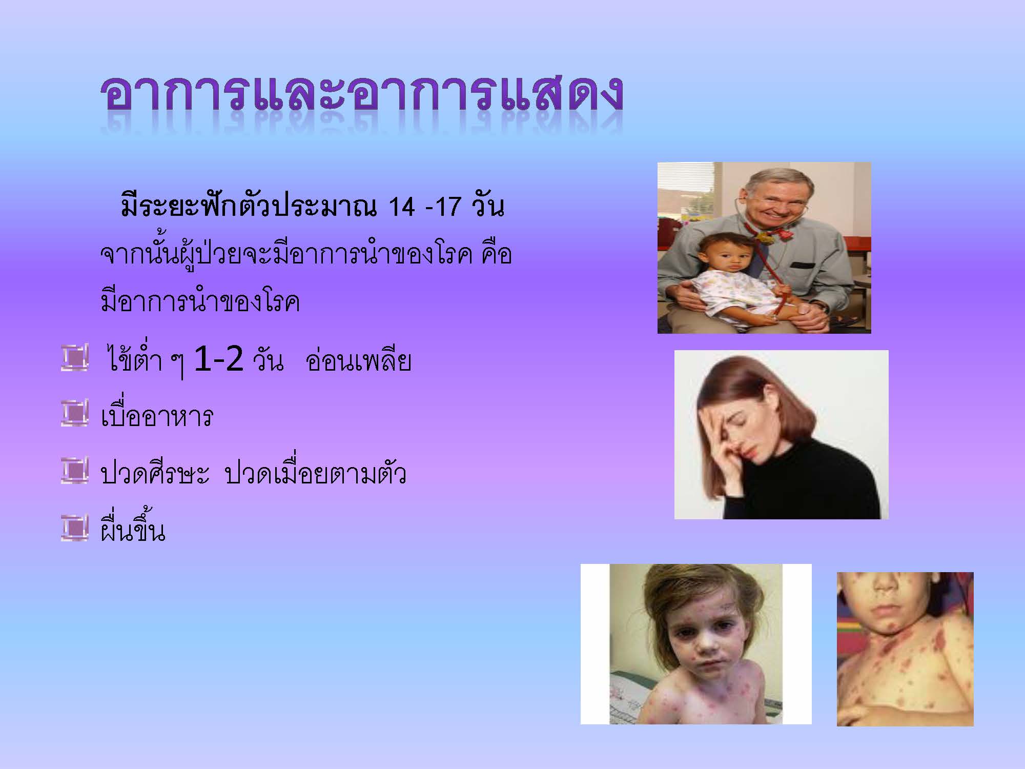 โรคสุกใส