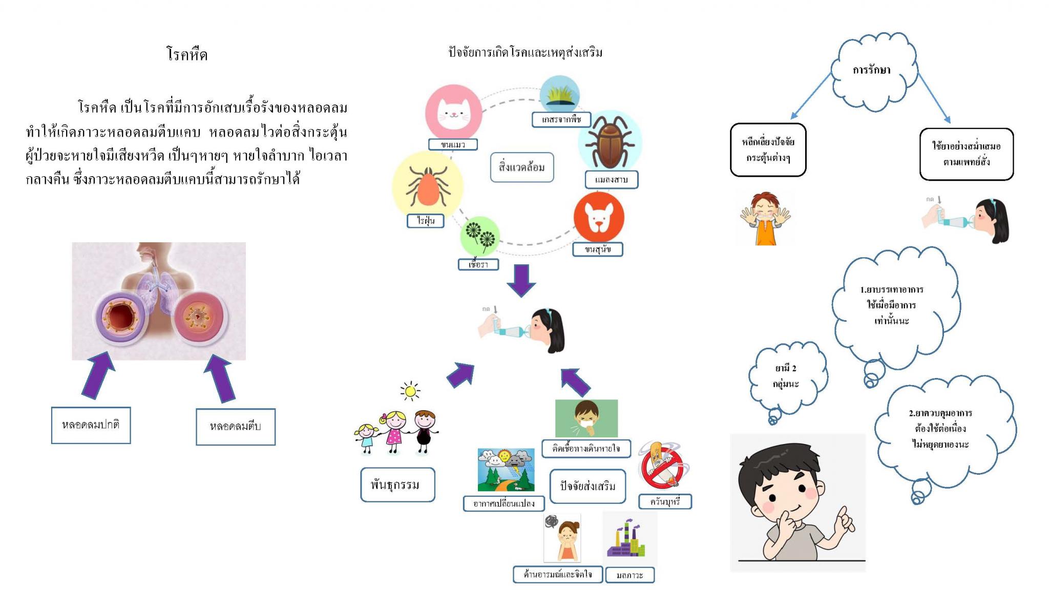 โรคหืด