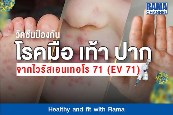 วัคซีนป้องกันโรคมือ เท้า ปาก จากไวรัสเอนเทอโร 71 (EV 71)