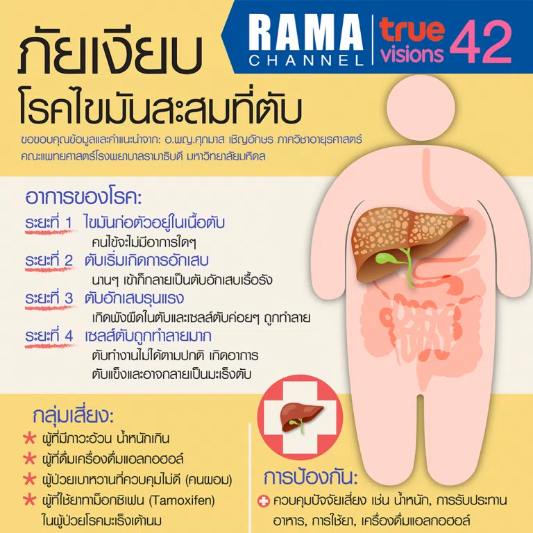 ภัยเงียบ โรคไขมันสะสมที่ตับ