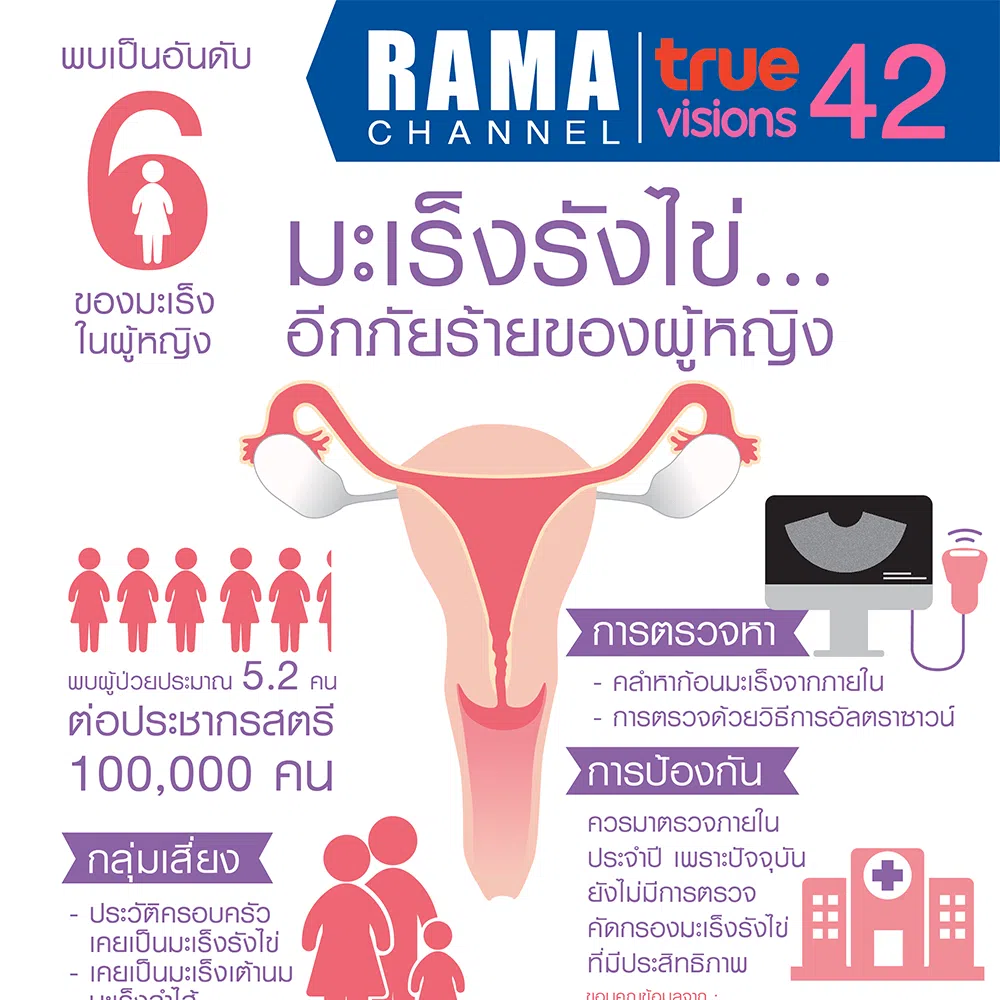 มะเร็งรังไข่...อีกภัยร้ายของผู้หญิง